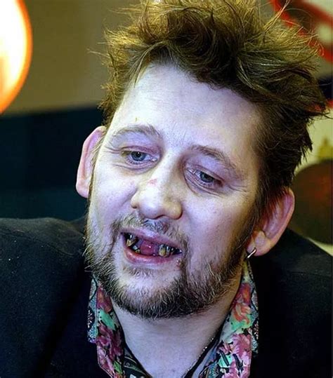 Fairytale of new TEETH! Shane MacGowan displays impressive new gnashers ...