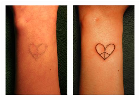 Madi's Peace-Heart Tattoo Repair by dadenko on DeviantArt