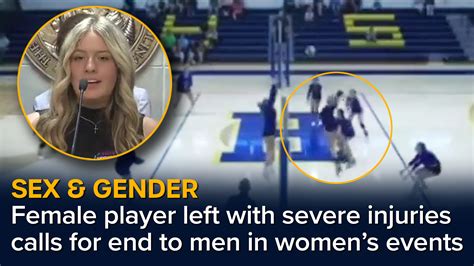 My life has changed forever' Volleyball student hit in the face by ...