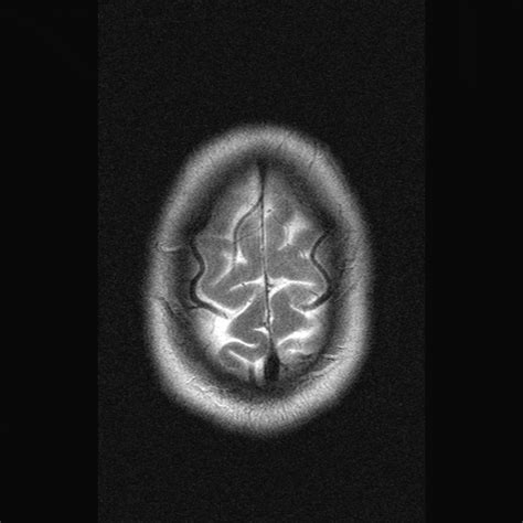 Brain Scan GIF - Find & Share on GIPHY