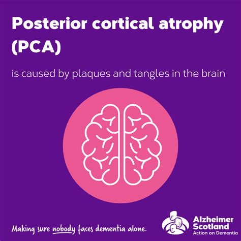 Posterior cortical atrophy | Alzheimer Scotland