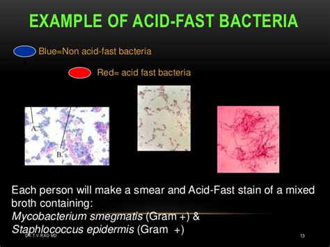 Acid fast bacteria (AFB)