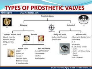 PROSTHETIC VALVES | PPT