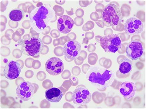 Does COVID-19 infect peripheral blood cells?