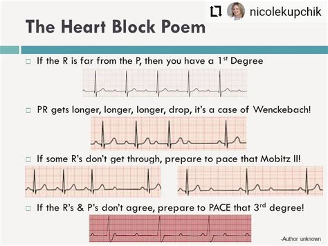 Love this! Great way to remember AV blocks in conduction! #Repost ...