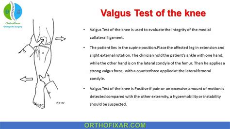 Valgus Stress Test Of The Knee | OrthoFixar 2024