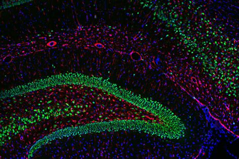 Multicolor Microscopy: The Importance of Multiplexing | Science Lab ...