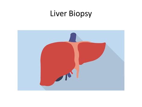 Liver Biopsy Procedures- How to do -Indication and position of Patient