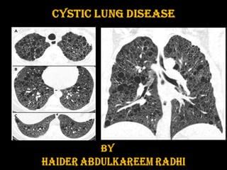 Cystic lung disease | PPT