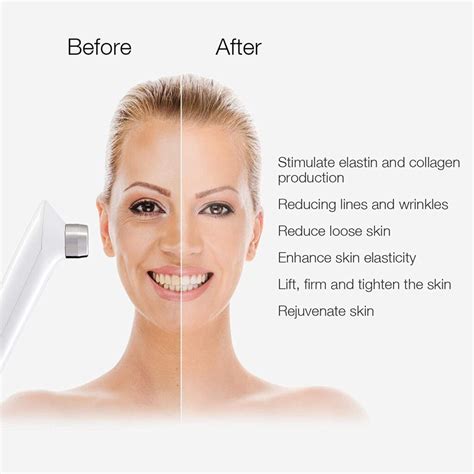 Be the first to review “MLAY RF Radio Frequency Facial And Body Skin ...