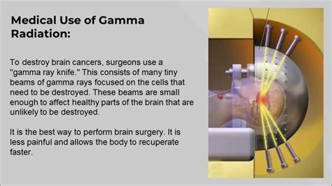 Non-Invasive Gamma Radiation Treatment - YouTube