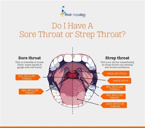 Strep Throat Causes Symptoms Diagnosis And Treatment | HOT SEXY GIRL