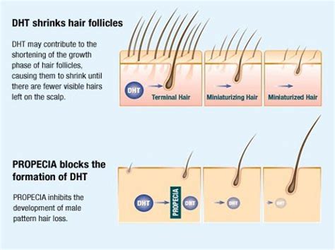 Hair Loss Medication Pros and Cons | Regaine and Propecia Side Effects