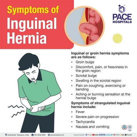 Inguinal Hernia - Signs and Symptoms, Types, Causes, Risk Factors