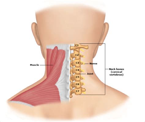 Cervical Spondylosis & Treatment