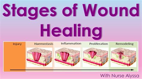 Stages of Wound Healing - YouTube