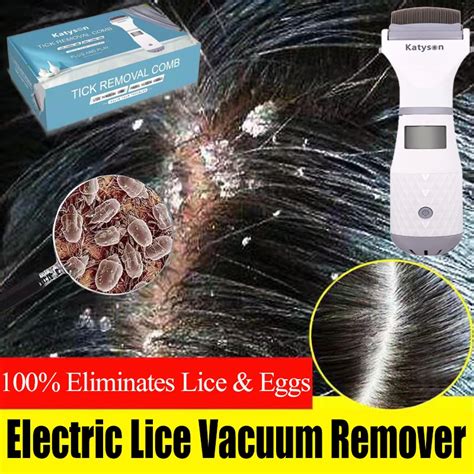 100%Eliminates Head Lice & Eggs Electric Lice Vacuum Remover Lice Eggs ...