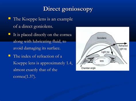 Gonioscopy presentation | PPT