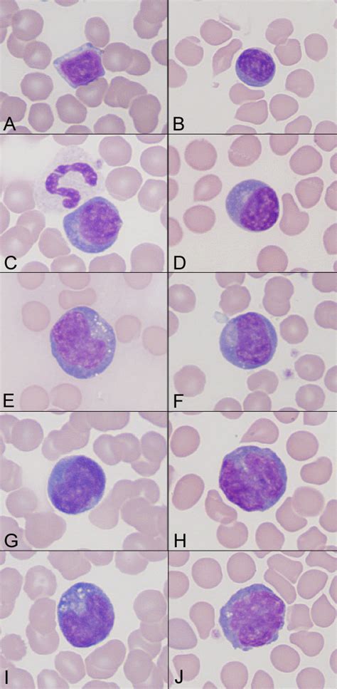 Reactive lymphocytes in a dog | eClinpath