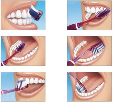 Técnica de cepillado | Brushing teeth, Dental, Dental health