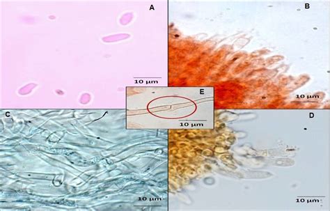 Light microscope photographs A. Basidiospores, B. Basidia, C. Pileus ...