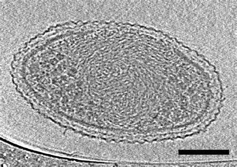 Bacterial Cell Under Electron Microscope