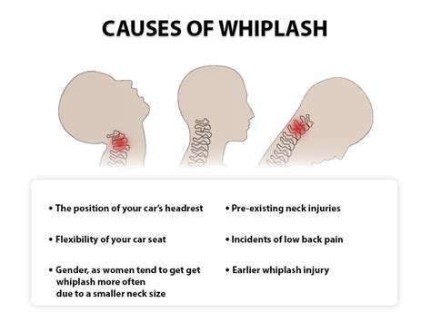 Neck Injury/Whiplash Doctors NJ & NYC