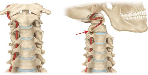 Body Posture: Alignment Is The Key for Health – TMD – Occlusion