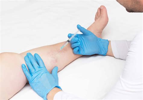 Harvard Trained Vein Doctor | Methods and Process for Vein Treatment NYC