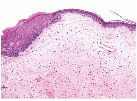 Vocal Cord Histology