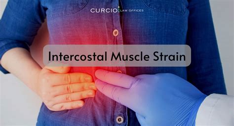 Intercostal Muscle Strain Symptoms