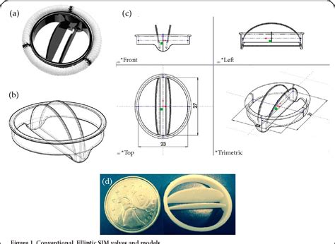 Figure 1 from Elliptic st. jude bileaflet mechanical heart valves ...