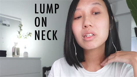 Lump On Neck Cancer Symptoms