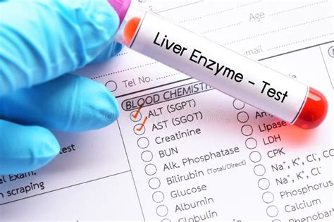 Liver enzyme test stock image. Image of medical, enzyme - 115061883