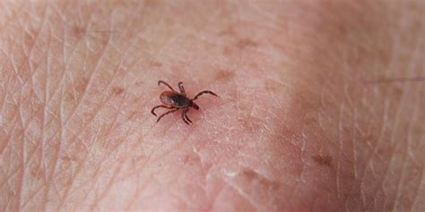 Where ticks bite: Check your thigh first, Upstate survey indicates ...