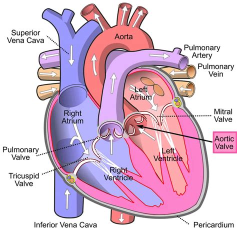 Aortic stenosis causes, symptoms, diagnosis, treatment & surgery