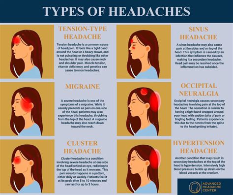 For more information about the nyc headache center, our doctors, or to ...