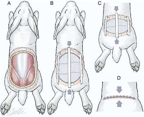 A, Tissue glue and some suture material is used to place adhesive pads ...