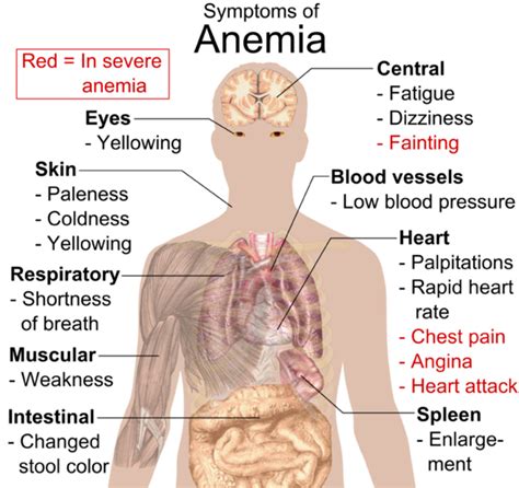 The Signs and Symptoms of Anemia - YouMeMindBody