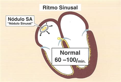 Electrocardiograma: Ritmo sinusal