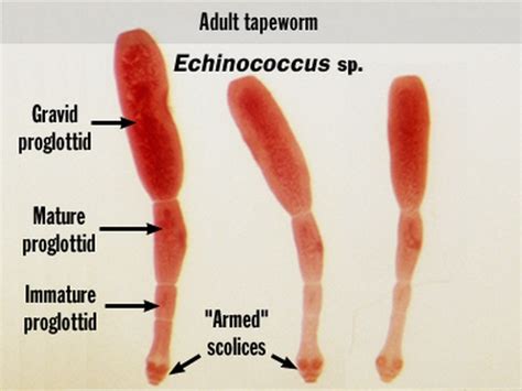 Medical Laboratory Technology - SOP: Echinococcus Granulosus