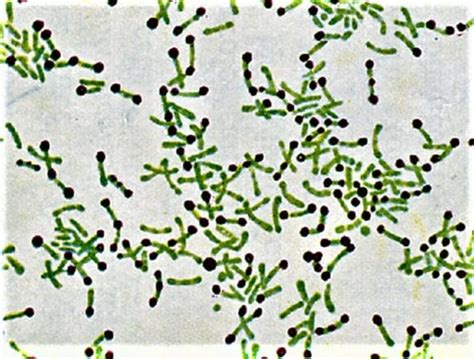 Corynebacterium Flashcards | Quizlet