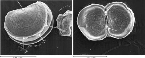 SEM picture of veliger larvae of M. galloprovincialis. The soft tissues ...