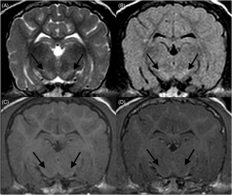 Transverse magnetic resonance images of the brain at the level of the ...