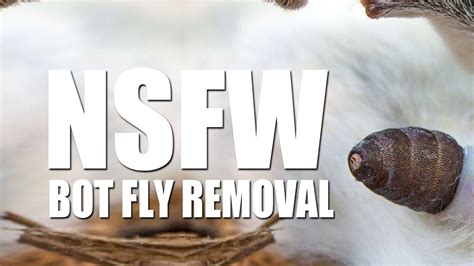 Bot Fly Removal! Top 10 Bot Fly Removal of All Time! - YouTube