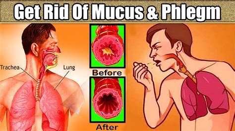 Constant Mucus In Throat