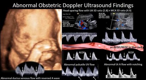 Fetal ultrasound heart rate | Ultrasound, Ultrasound sonography ...