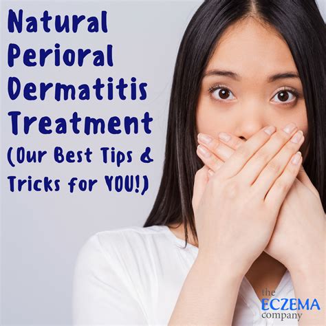 Natural Perioral Dermatitis Treatment (Our Best Tips & Tricks for YOU!)