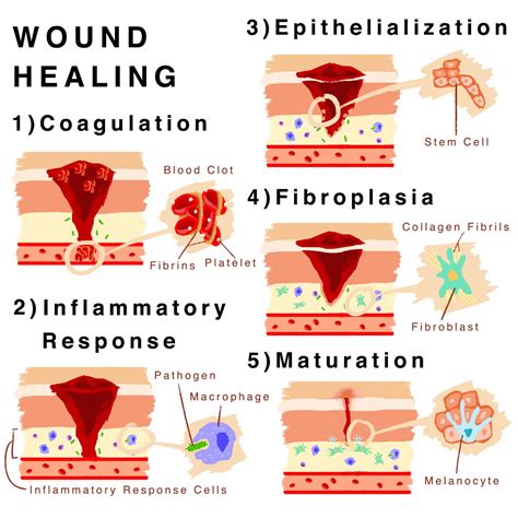 Skin Regeneration in Wound Healing: The Art of Self Preservation – SQ ...