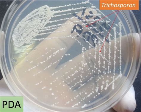 Trichosporon: Introduction, colony characteristics, pathogenecity